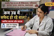 Hair Care Tips : क्या आपके बच्चों के बाल हो रहे सफेद? न करें ये गलती, गाजियाबाद की डॉक्टर ने बताई वजह