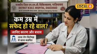 Hair Care Tips : क्या आपके बच्चों के बाल हो रहे सफेद? न करें ये गलती, गाजियाबाद की डॉक्टर ने बताई वजह