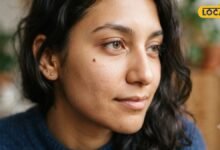 Mole Removal Treatment: चेहरे पर तिल-मस्सा बन रहा है परेशानी? डॉक्टर से जानें हटाने का सही और सुरक्षित तरीका