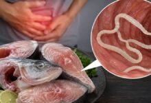 Tapeworms in Fish: सावधान! बारिश में खाई ये 6 मछलियां तो शरीर में पहुंच सकता है 30 फीट लंबा टेपवर्म