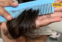 Hair Care : क्या आपके बाल भी अचानक झड़ने लगे हैं? सिर्फ शैंपू बदलने से नहीं होगा काम, पूरी करनी होगा ये कमी