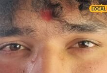 eye care tips | eye protection | eye health care | 60 की उम्र तक आंखों को रखना है सही, तो मान लें ये 5 जरूरी सलाह, चश्मे से रहेंगे दूर