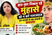 चेहरे पर बार-बार निकल रहे हैं मुंहासे तो न करें नजरअंदाज, जानिए कारण और सही इलाज