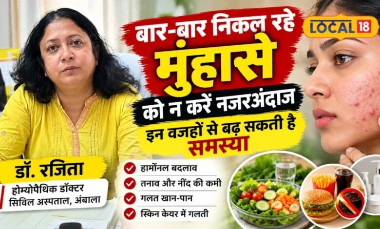 चेहरे पर बार-बार निकल रहे हैं मुंहासे तो न करें नजरअंदाज, जानिए कारण और सही इलाज