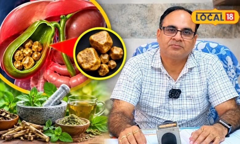 पित्त की पथरी से हैं परेशान, तो यहां जानिए क्या खाएं और किन चीजों से बनाएं दूरी