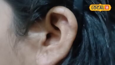 Health Tips : हो जाओगे बहरे...कान की मैल निकालने का ये तरीका घातक, डॉक्टर ने बताई सही ट्रिक