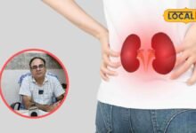 health care tips | kidni disease | health tips | अगर ये बुरी आदतें हैं तो जल्दी छोड़ दीजिए, वरना चुपचाप किडनी कर देंगी खराब, डॉक्टर ने दी चेतावनी