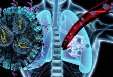 for_you
