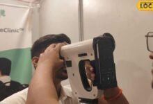 रांची में दिखी गन जैसी दिखने वाली आंखों की मशीन, 30 सेकंड में बताएगी किडनी हार्ट की भविष्य की बीमारी