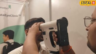 रांची में दिखी गन जैसी दिखने वाली आंखों की मशीन, 30 सेकंड में बताएगी किडनी हार्ट की भविष्य की बीमारी